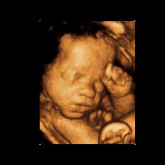 3d baby scans and 4d baby scans