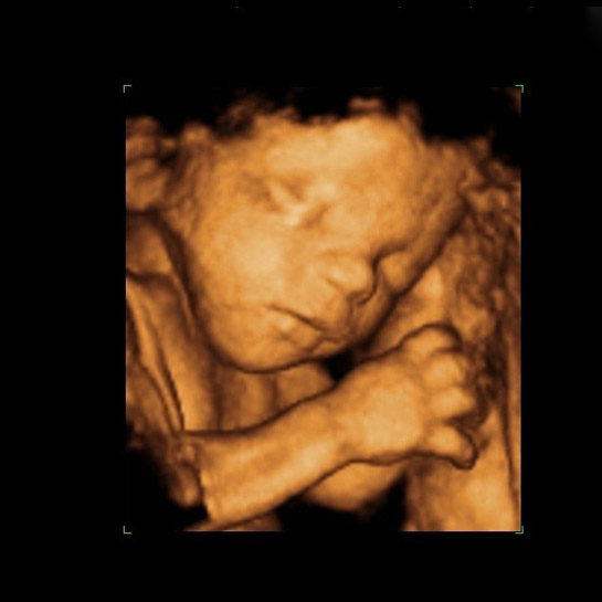 3d baby scan 4d baby scan